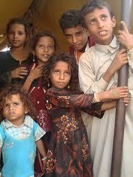 اليمن من ضمن أكثر البلدان سوءاً في التغذية .. اليونسيف :  250 ألف طفل يمني يعانون من سوء التغذية الحاد